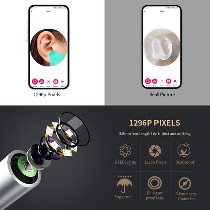 Ear Cleaning Tool with HD Camera and LED Lights Earwax Removal Otoscope